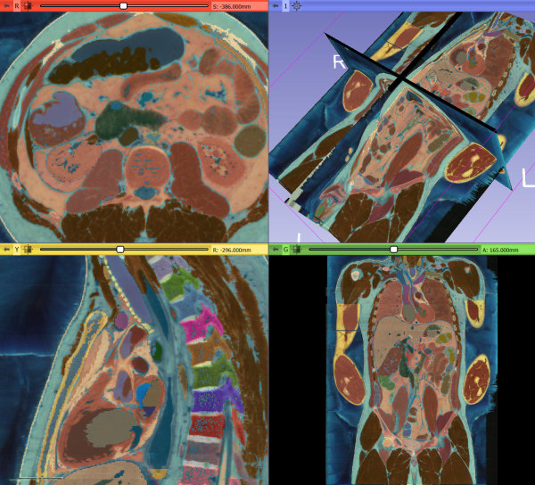 Voxel-man abdominal atlas